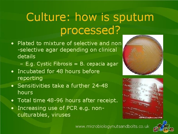 Culture: how is sputum processed? • Plated to mixture of selective and non -selective