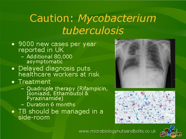 Caution: Mycobacterium tuberculosis • 9000 new cases per year reported in UK – Additional