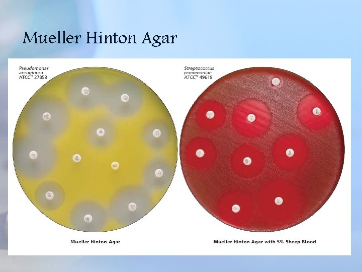 Mueller Hinton Agar 