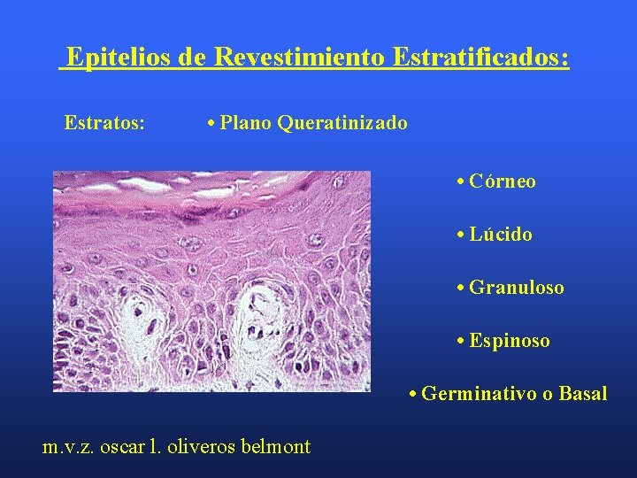 Epitelios de Revestimiento Estratificados: Estratos: • Plano Queratinizado • Córneo • Lúcido • Granuloso