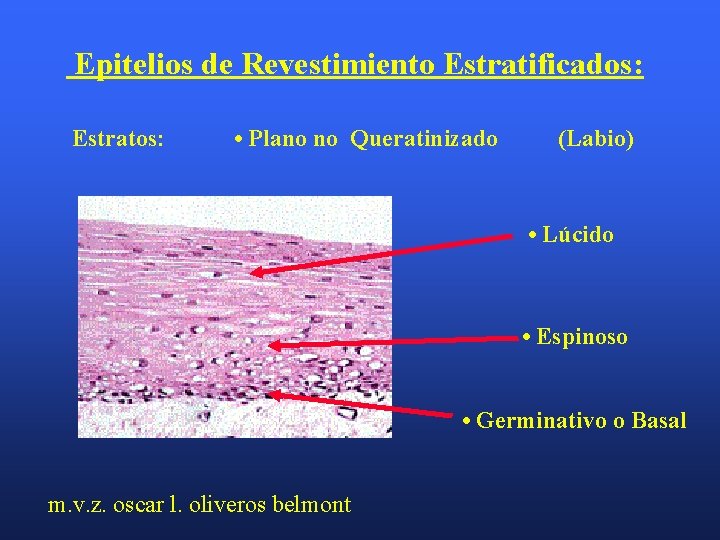 Epitelios de Revestimiento Estratificados: Estratos: • Plano no Queratinizado (Labio) • Lúcido • Espinoso