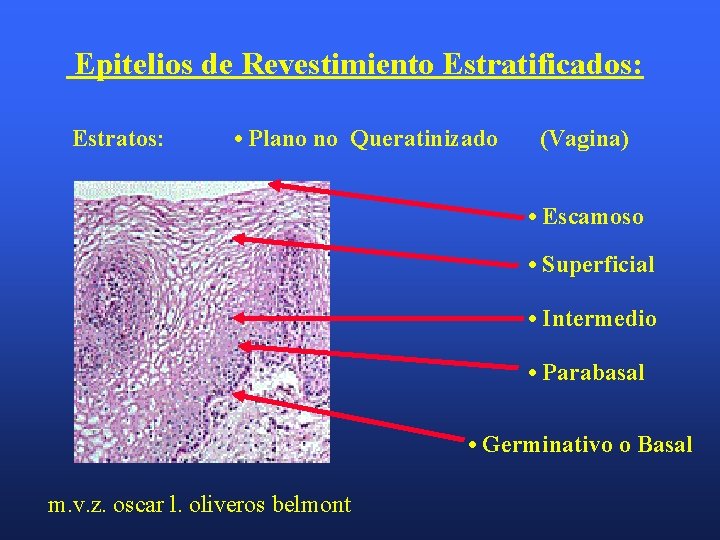 Epitelios de Revestimiento Estratificados: Estratos: • Plano no Queratinizado (Vagina) • Escamoso • Superficial