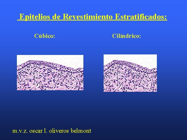 Epitelios de Revestimiento Estratificados: Cúbico: m. v. z. oscar l. oliveros belmont Cilíndrico: 