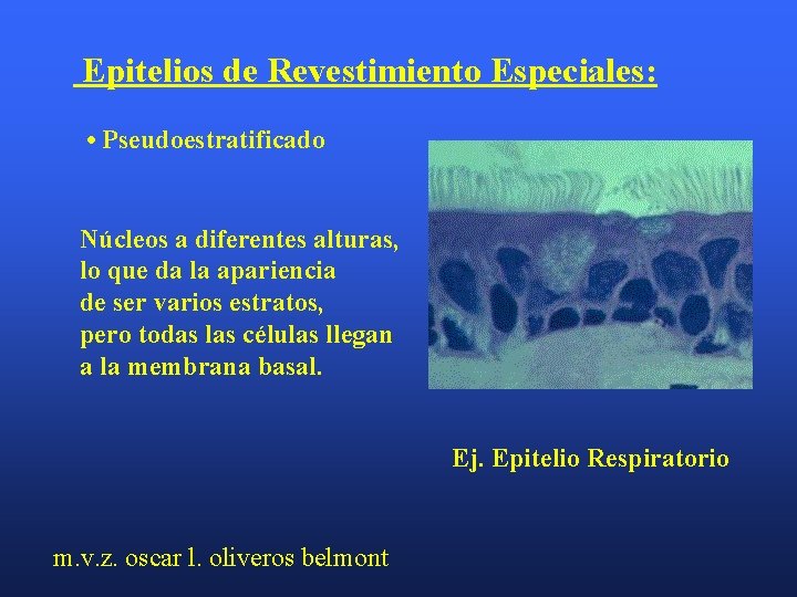 Epitelios de Revestimiento Especiales: • Pseudoestratificado Núcleos a diferentes alturas, lo que da la