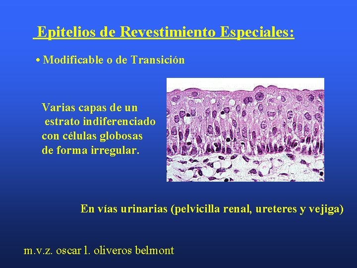 Epitelios de Revestimiento Especiales: • Modificable o de Transición Varias capas de un estrato