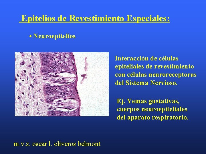 Epitelios de Revestimiento Especiales: • Neuroepitelios Interacción de células epiteliales de revestimiento con células