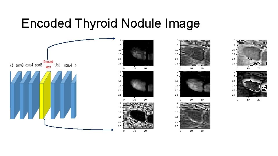 Encoded Thyroid Nodule Image Encoded Thyroid Nodule Image