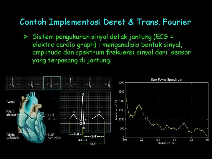 Contoh Implementasi Deret & Trans. Fourier Ø Sistem pengukuran sinyal detak jantung (ECG =