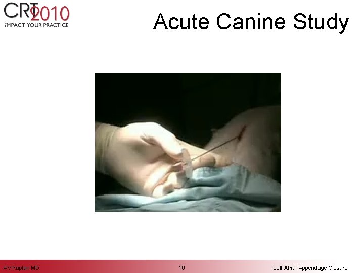 Acute Canine Study AV Kaplan MD 10 Left Atrial Appendage Closure 