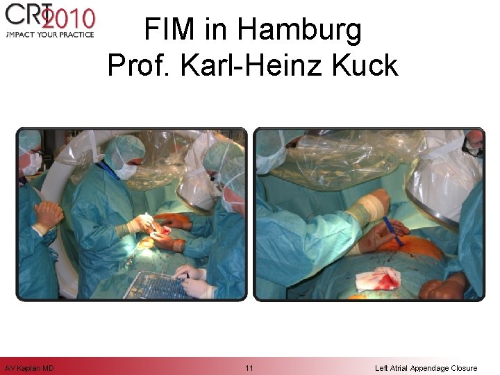 FIM in Hamburg Prof. Karl-Heinz Kuck AV Kaplan MD 11 Left Atrial Appendage Closure