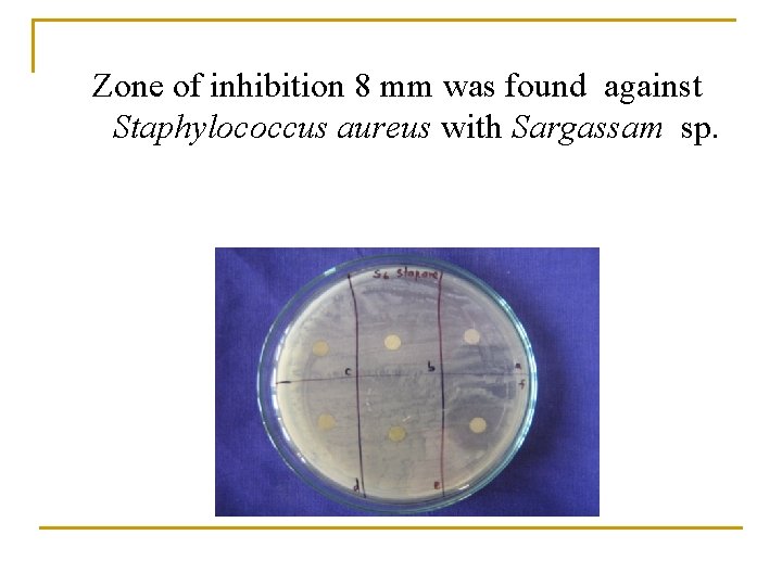 Zone of inhibition 8 mm was found against Staphylococcus aureus with Sargassam sp. Zone of inhibition 8 mm was found against Staphylococcus aureus with Sargassam sp.