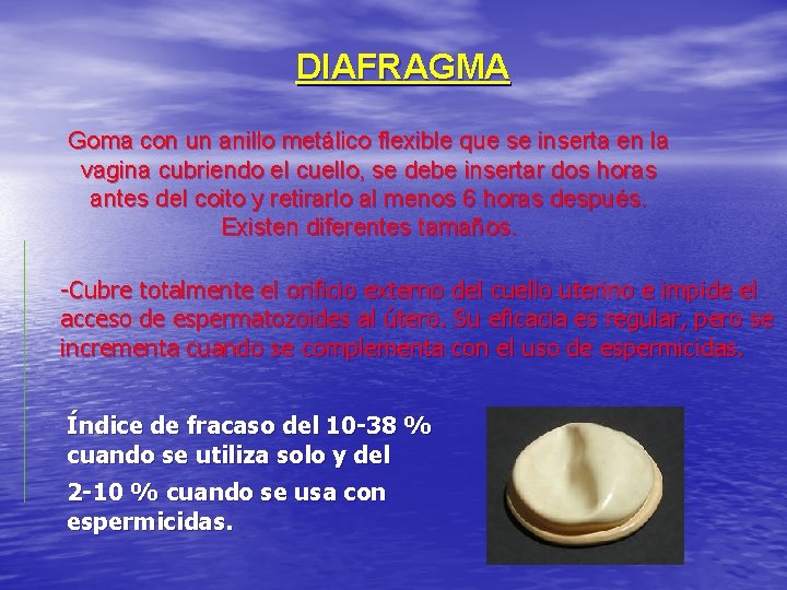 DIAFRAGMA Goma con un anillo metálico flexible que se inserta en la vagina cubriendo