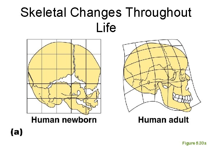 Skeletal Changes Throughout Life Figure 5. 33 a Skeletal Changes Throughout Life Figure 5. 33 a