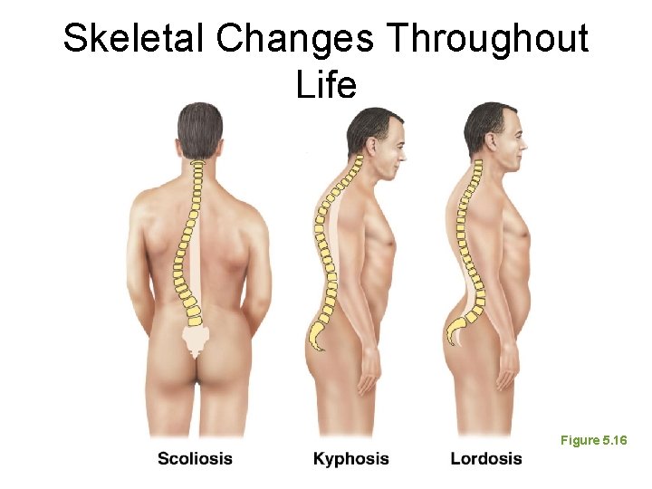 Skeletal Changes Throughout Life Figure 5. 16 Skeletal Changes Throughout Life Figure 5. 16
