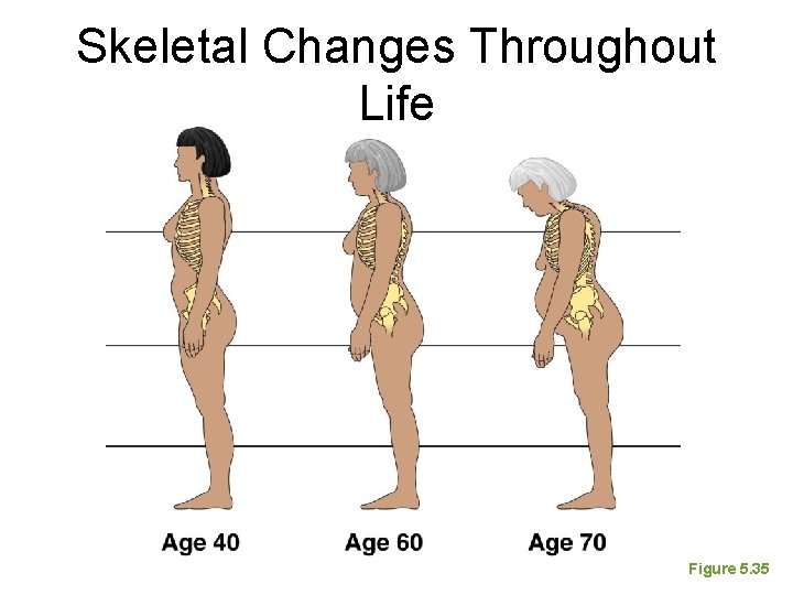 Skeletal Changes Throughout Life Figure 5. 35 Skeletal Changes Throughout Life Figure 5. 35