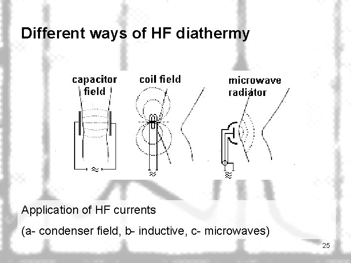 Different ways of HF diathermy Application of HF currents (a- condenser field, b- inductive,