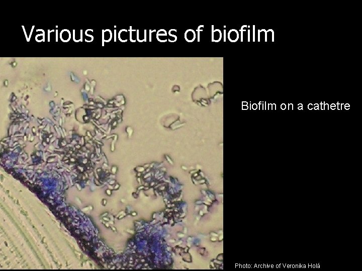 Various pictures of biofilm Biofilm on a cathetre Photo: Archive of Veronika Holá 
