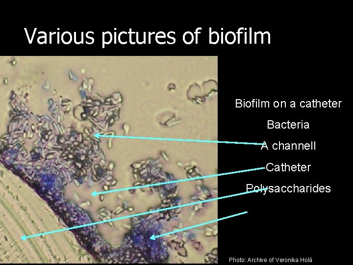 Various pictures of biofilm Biofilm on a catheter Bacteria A channell Catheter Polysaccharides Photo: