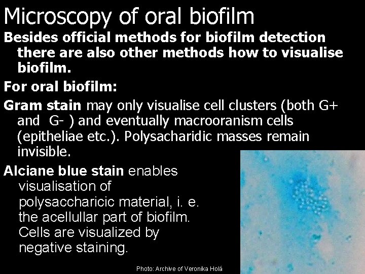 Microscopy of oral biofilm Besides official methods for biofilm detection there also other methods