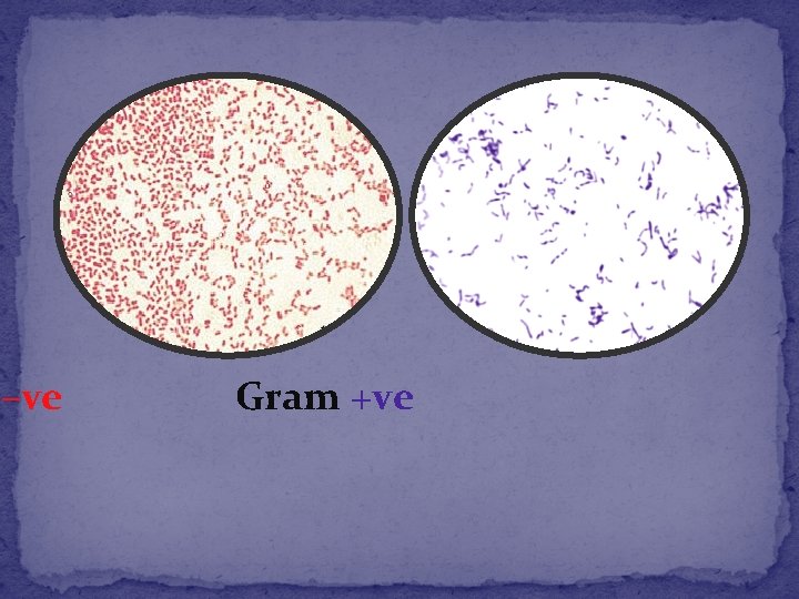  –ve Gram +ve 