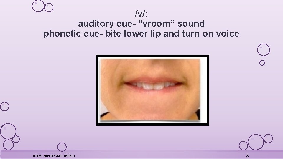 /v/: auditory cue- “vroom” sound phonetic cue- bite lower lip and turn on voice