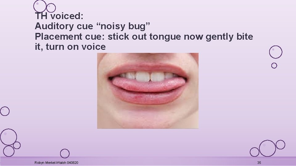 TH voiced: Auditory cue “noisy bug” Placement cue: stick out tongue now gently bite