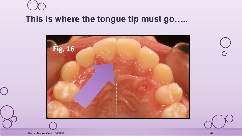 This is where the tongue tip must go…. . Robyn Merkel-Walsh 040820 44 