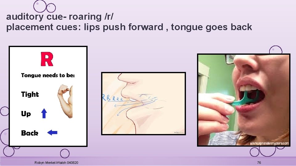 auditory cue- roaring /r/ placement cues: lips push forward , tongue goes back Robyn