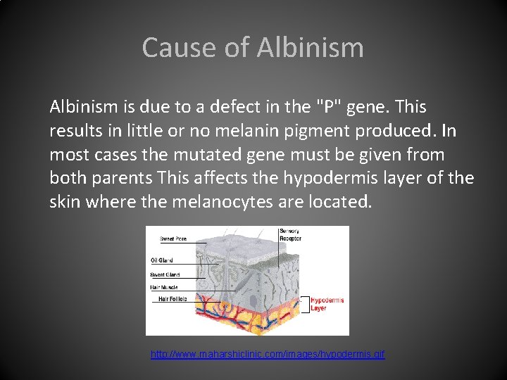 Cause of Albinism is due to a defect in the "P" gene. This results