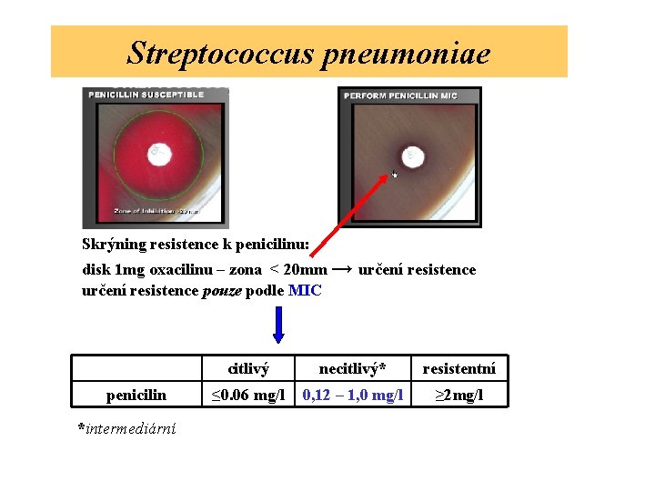 Streptococcus pneumoniae Skrýning resistence k penicilinu: disk 1 mg oxacilinu – zona < 20