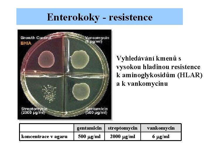 Enterokoky - resistence Vyhledávání kmenů s vysokou hladinou resistence k aminoglykosidům (HLAR) a k