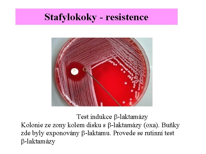 Stafylokoky - resistence Test indukce b-laktamázy Kolonie ze zony kolem disku s b-laktamázy (oxa).