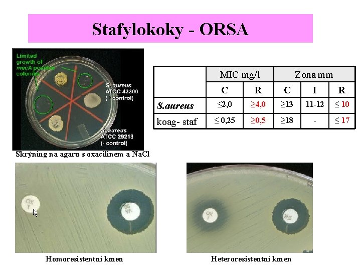 Stafylokoky - ORSA MIC mg/l Zona mm C R C I R S. aureus