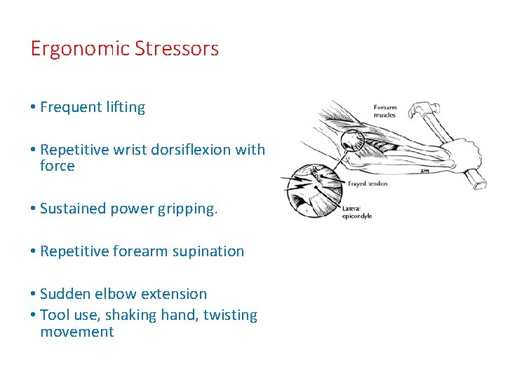 Ergonomic Stressors • Frequent lifting • Repetitive wrist dorsiflexion with force • Sustained power