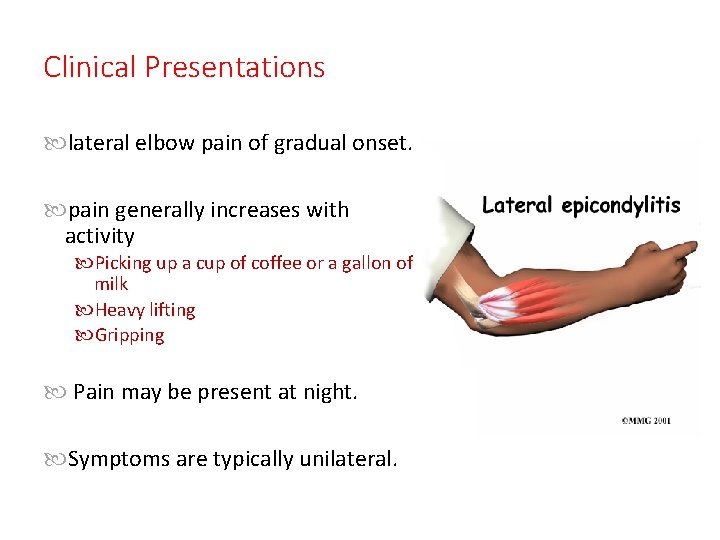 Clinical Presentations lateral elbow pain of gradual onset. pain generally increases with activity Picking