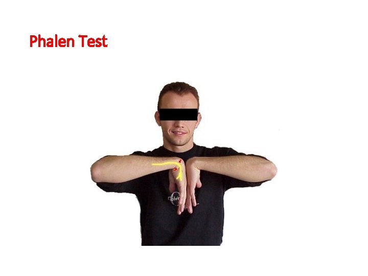 Phalen Test 