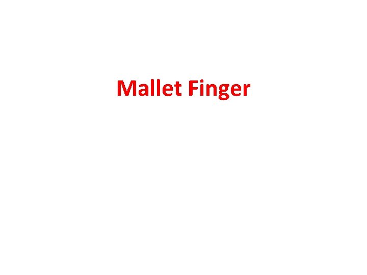 Mallet Finger 