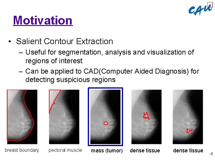 Motivation • Salient Contour Extraction – Useful for segmentation, analysis and visualization of regions