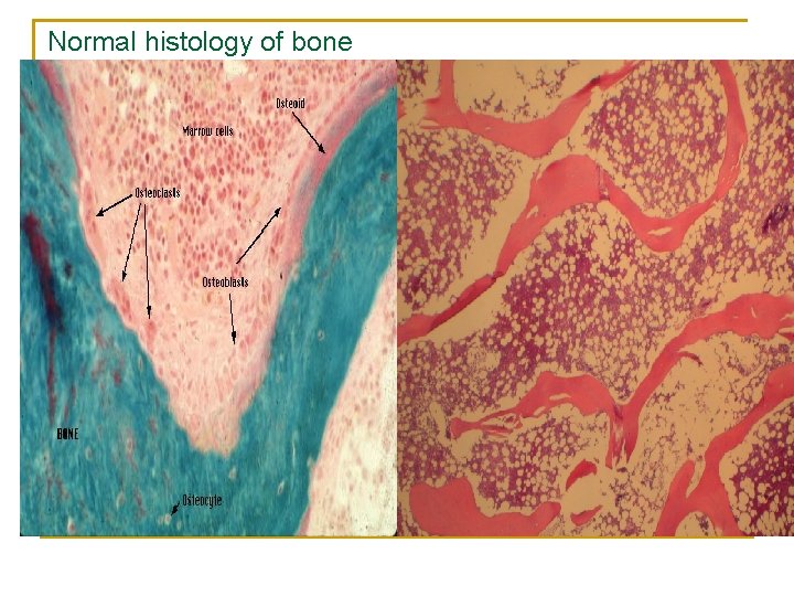 Normal histology of bone 