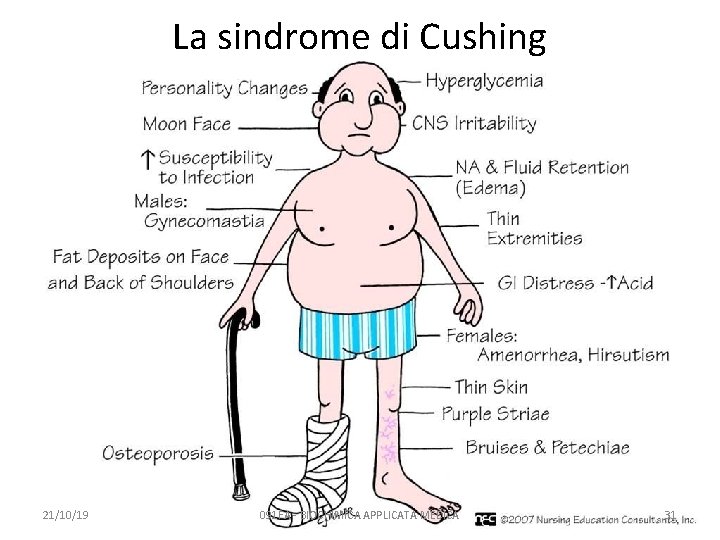 La sindrome di Cushing 21/10/19 091 FA - BIOCHIMICA APPLICATA MEDICA 31 