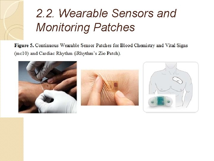 2. 2. Wearable Sensors and Monitoring Patches 