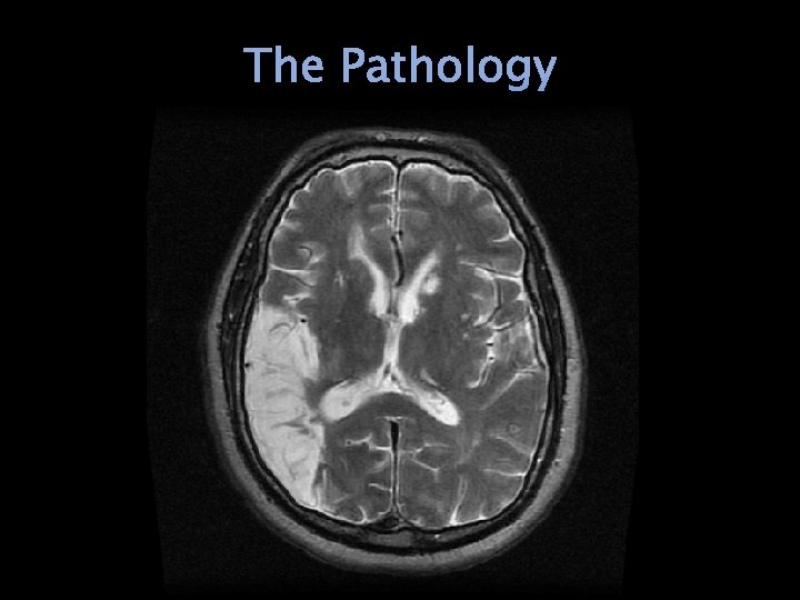 The Pathology 