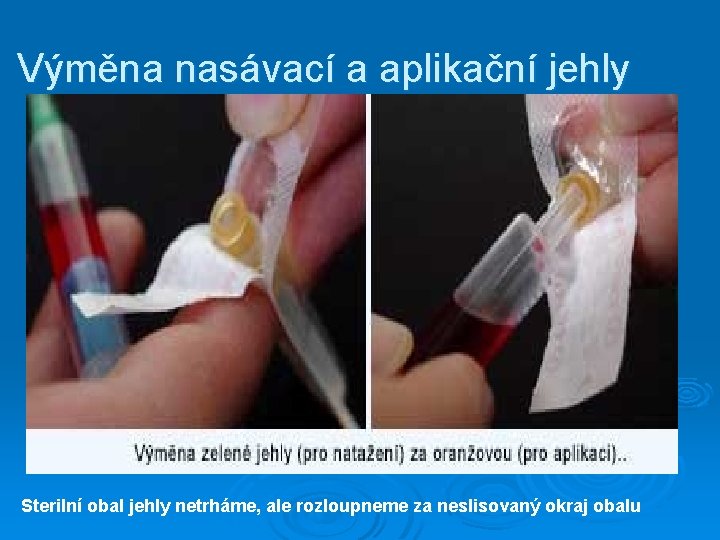 Výměna nasávací a aplikační jehly Sterilní obal jehly netrháme, ale rozloupneme za neslisovaný okraj