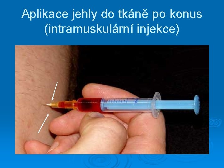 Aplikace jehly do tkáně po konus (intramuskulární injekce) 
