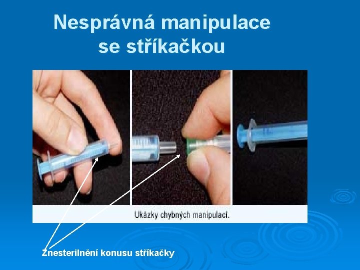 Nesprávná manipulace se stříkačkou Znesterilnění konusu stříkačky 
