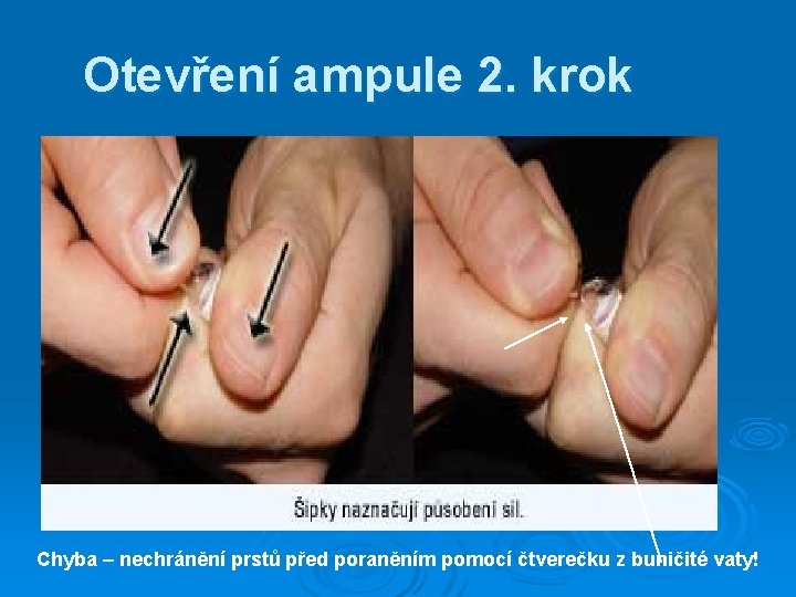 Otevření ampule 2. krok Chyba – nechránění prstů před poraněním pomocí čtverečku z buničité