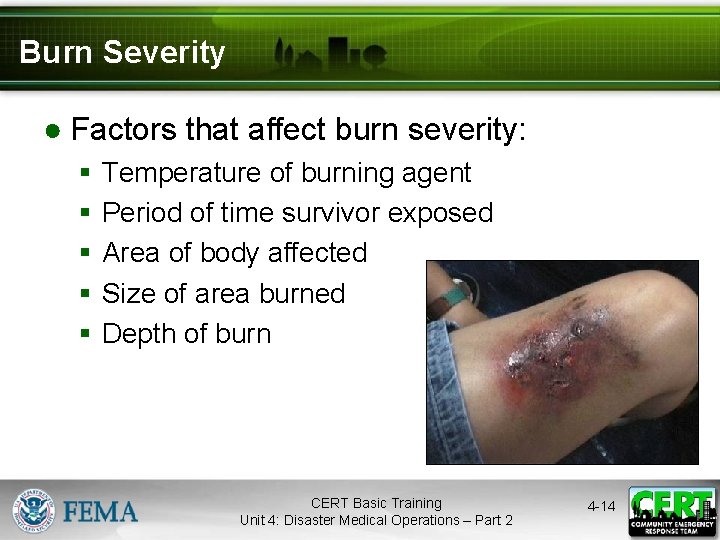 Burn Severity ● Factors that affect burn severity: § § § Temperature of burning
