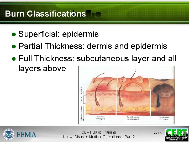 Burn Classifications ● Superficial: epidermis ● Partial Thickness: dermis and epidermis ● Full Thickness: