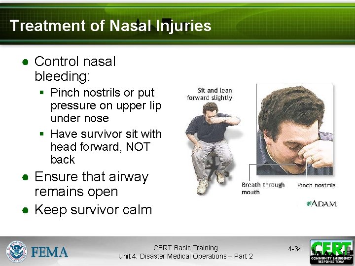 Treatment of Nasal Injuries ● Control nasal bleeding: § Pinch nostrils or put pressure