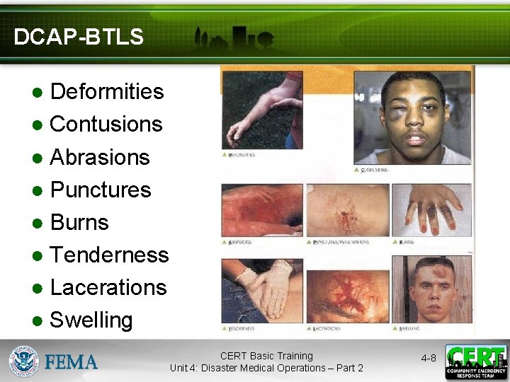 DCAP-BTLS ● Deformities ● Contusions ● Abrasions ● Punctures ● Burns ● Tenderness ●